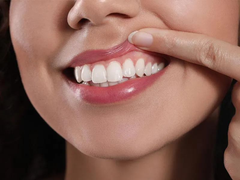 Woman looking at gums